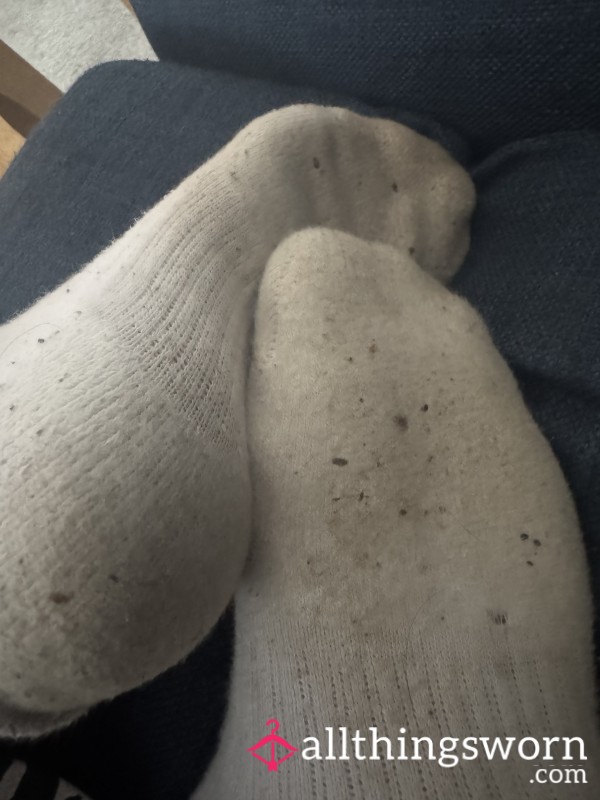 3-Day Toe Trap – Crusty Sock Experience🧦