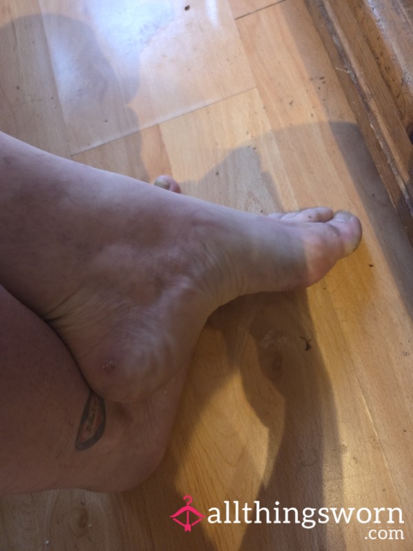 5 Pictures With The Toe Nail Polish Of Your Choice