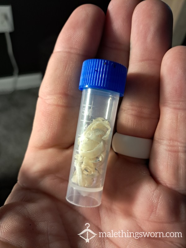 5ml Vial Of Alphas Toe Nails