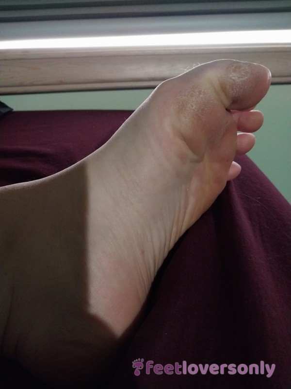 Arches