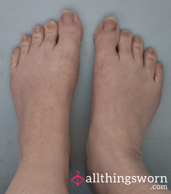 "Au Naturel" Or Ugly Feet! Never Seen Before Photos X 5!