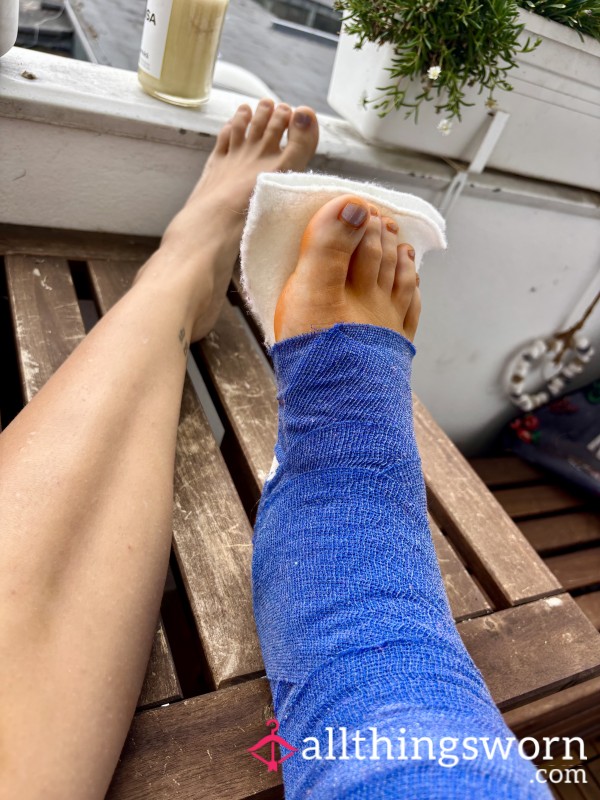 Bandaged Beauty: 5 Photo Recovery Set With Iced Cast, Fresh Wraps & Soft Soles 💙