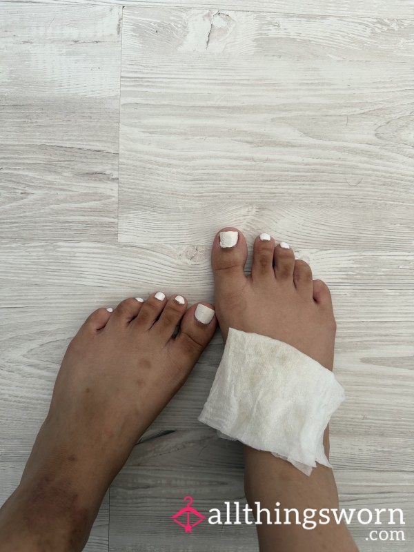 Barefoot White Toes With My Dirty Baby Wipe Placed On Top After Cleaning My Feet With It