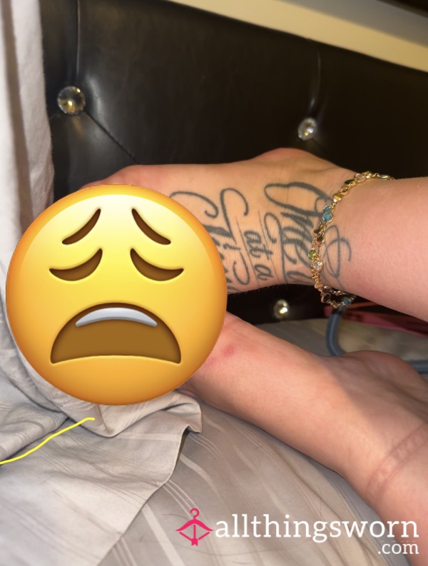 Beat Up Painful Feet