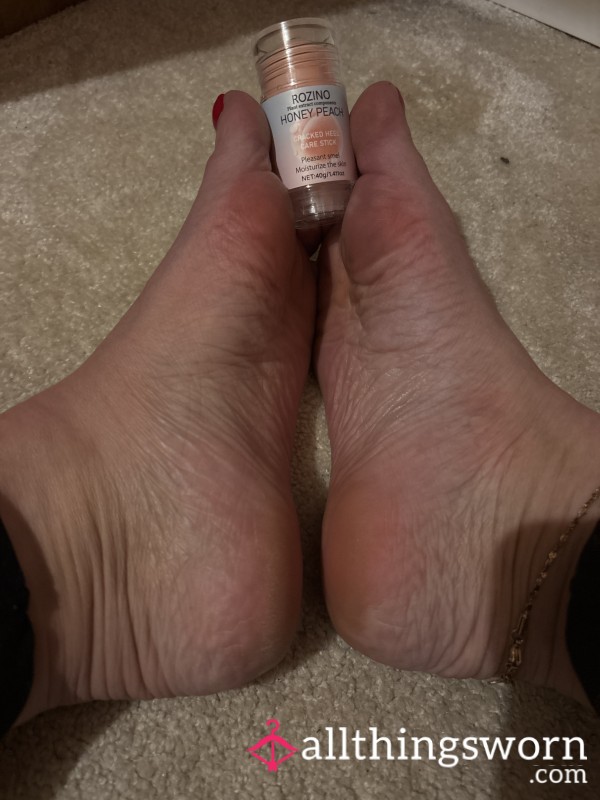 Been Totally Influenced By This Foot Balm