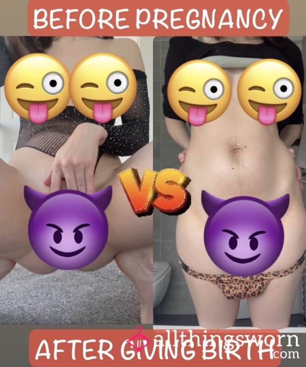 Before Pregnancy VS After Giving Birth Body!