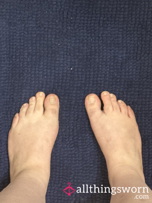 Big Lady Feet, Hairy Knuckles