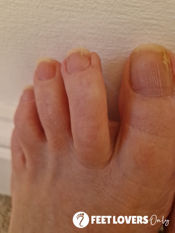 BIG Toe Jam