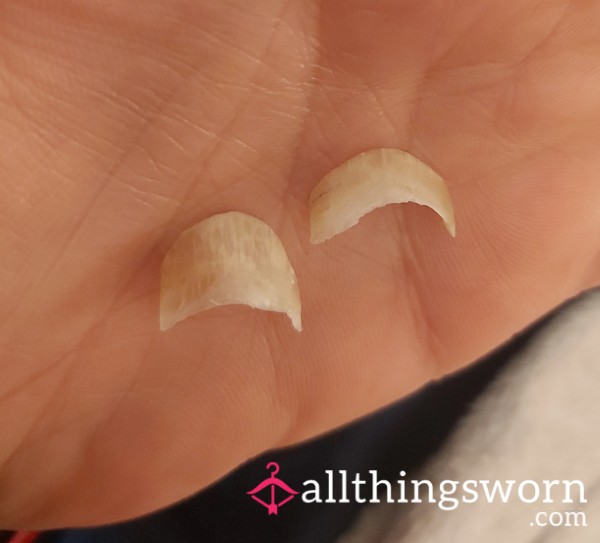 Big Toe Nail Ends!!