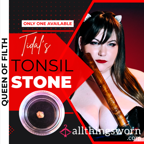 BIO | Tonsil Stone