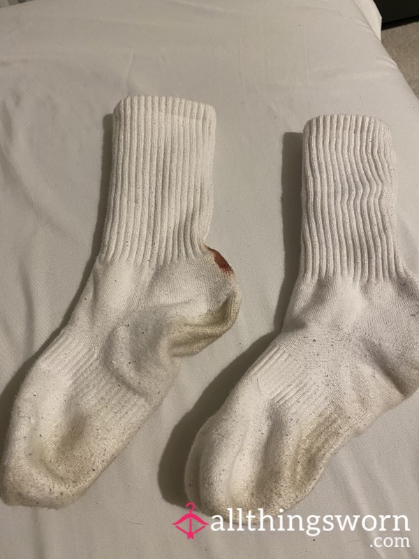 Blister Burst Socks