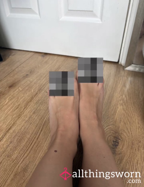 Blistered Feet Pics 👣
