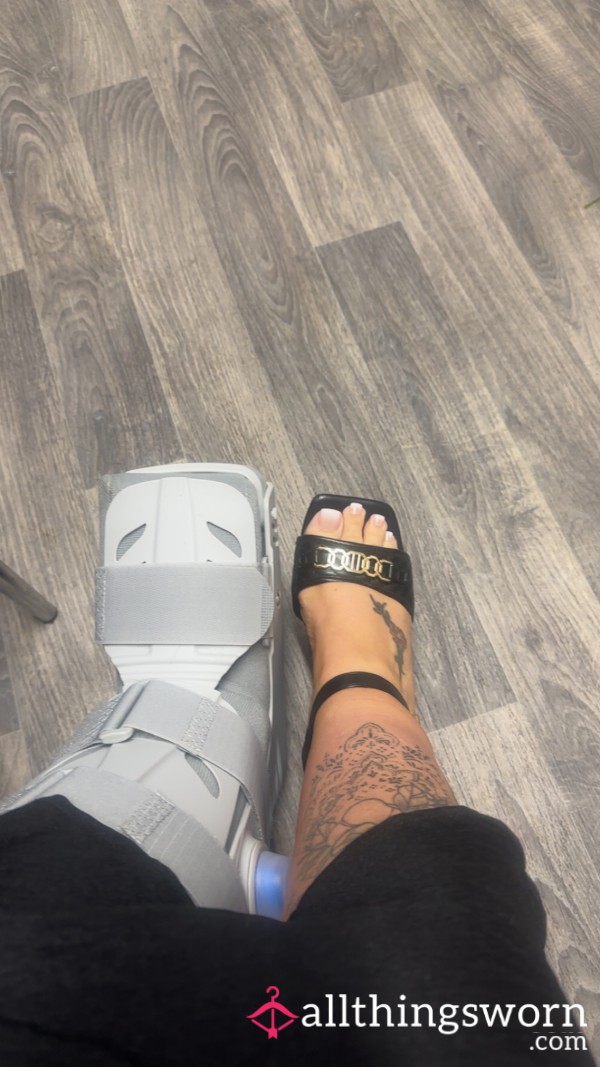 Broken Toe