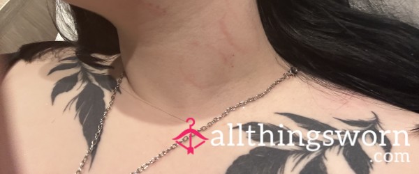 Bruises And Bites 💕✨