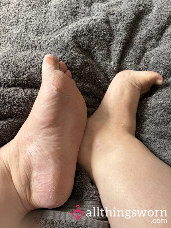 Buffering My Feet