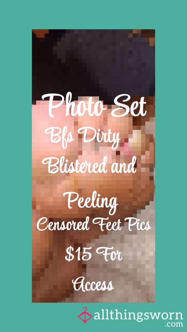 Censored Photo Set| Bfs Censored Dirty Blistered And P**ling Feet Pics| 10 Photos