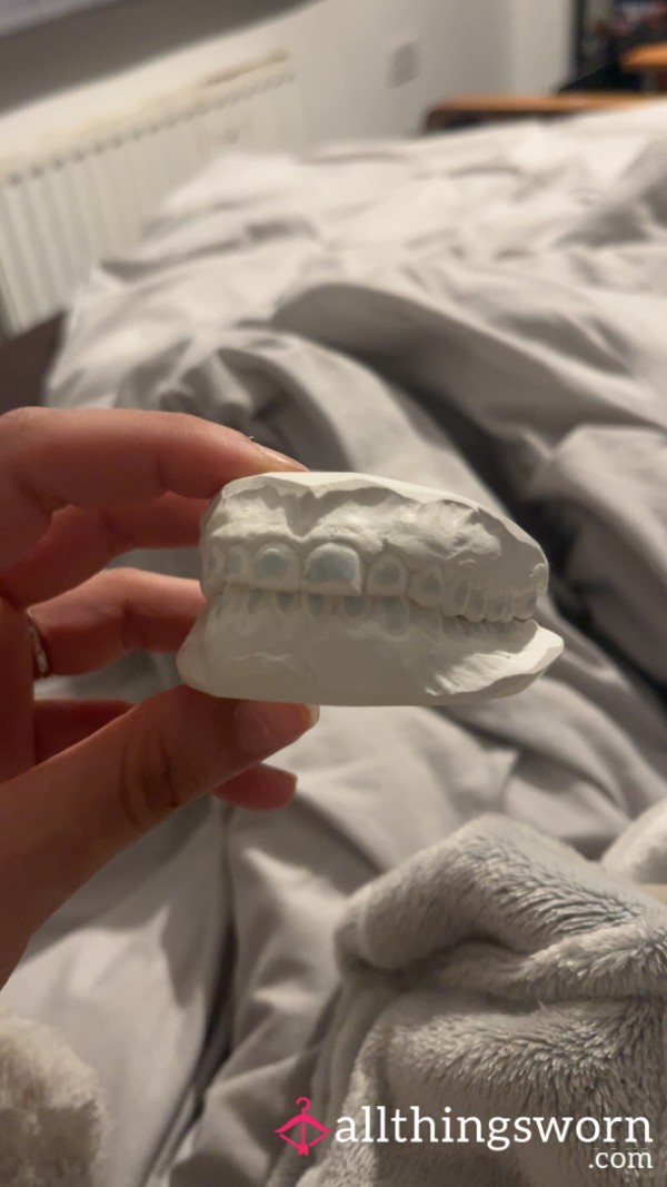 Ceramic Cast Of My Teeth 🦷
