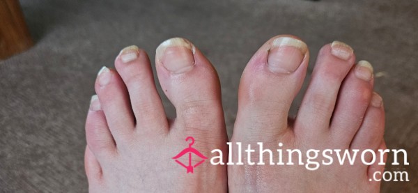 Clipping Toenails