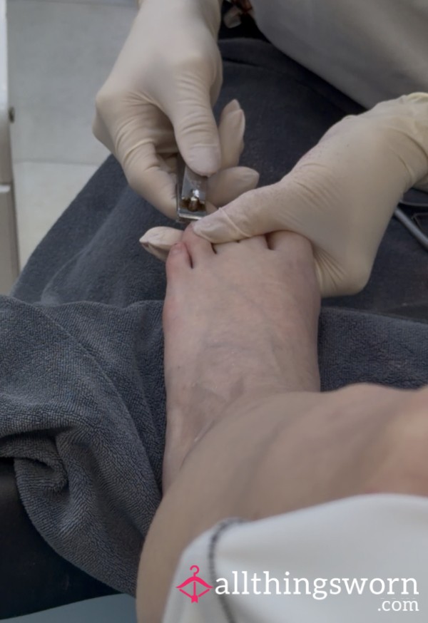 Close-Up Toenail Clipping & Cleaning… Every Detail 👀