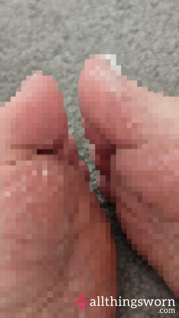 Close Ups Of My Needy Dry Feet 👣