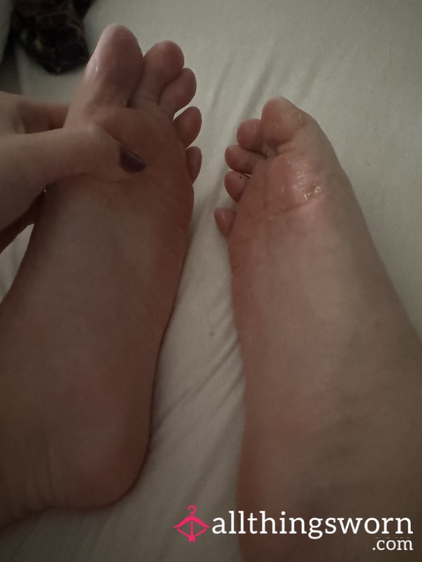 🦶 Closeup Dry Crusty Feet Pics🦶