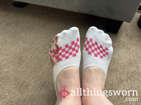 Concert Socks I Broke My Toe In 🤷‍♀️
