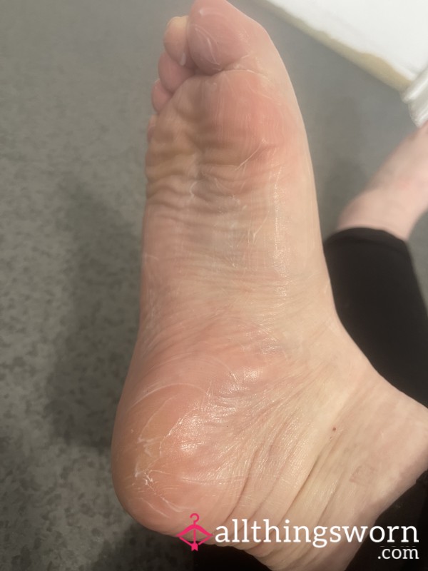 Creamed Feet