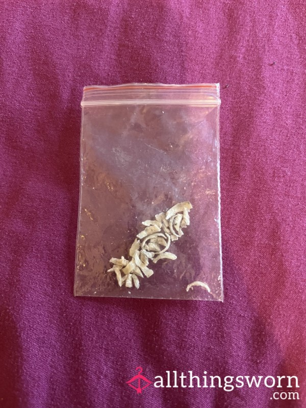 Crunchy Toenails