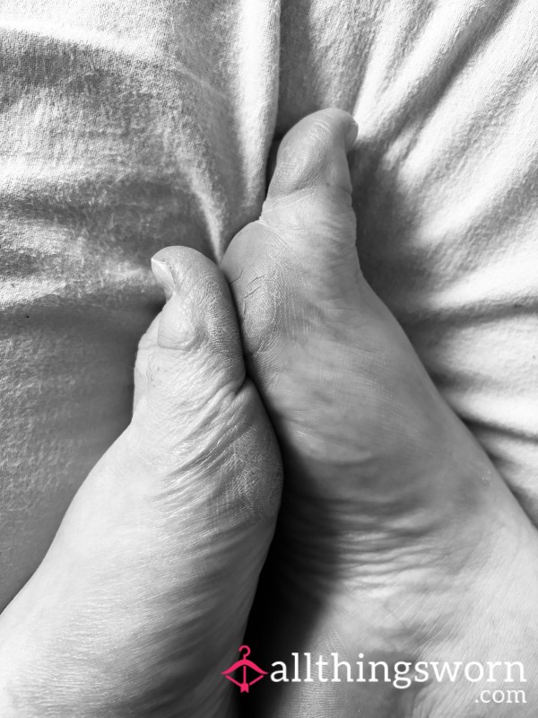 Crusty Callous Feet