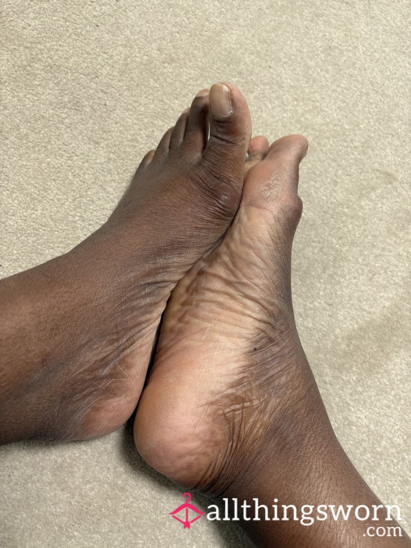 Crusty Dusty Feet Pics! 🦶🏾
