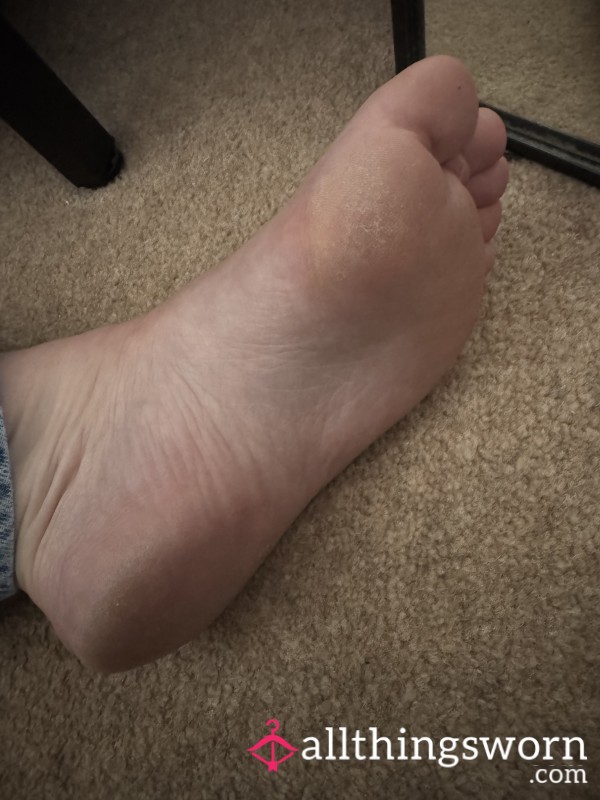 Crusty Feet