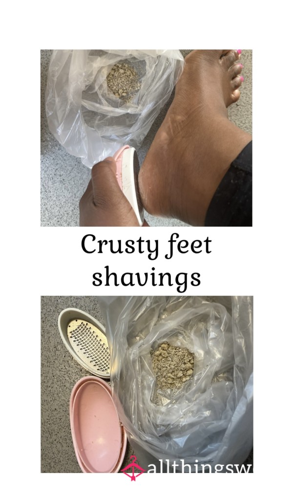 Crusty Feet 👣