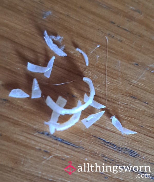 Crusty Toenails