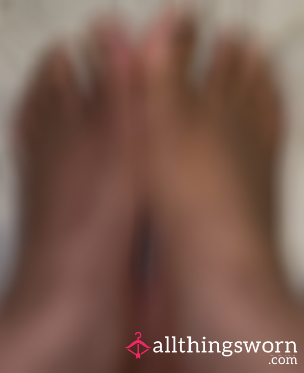 Crusty Toes Waiting To Be Cleaned