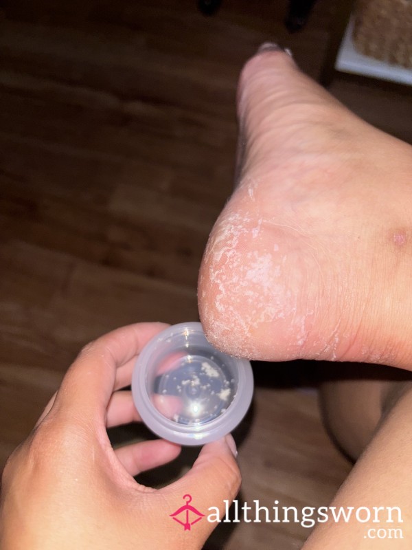 Dead Foot Skin / P**l