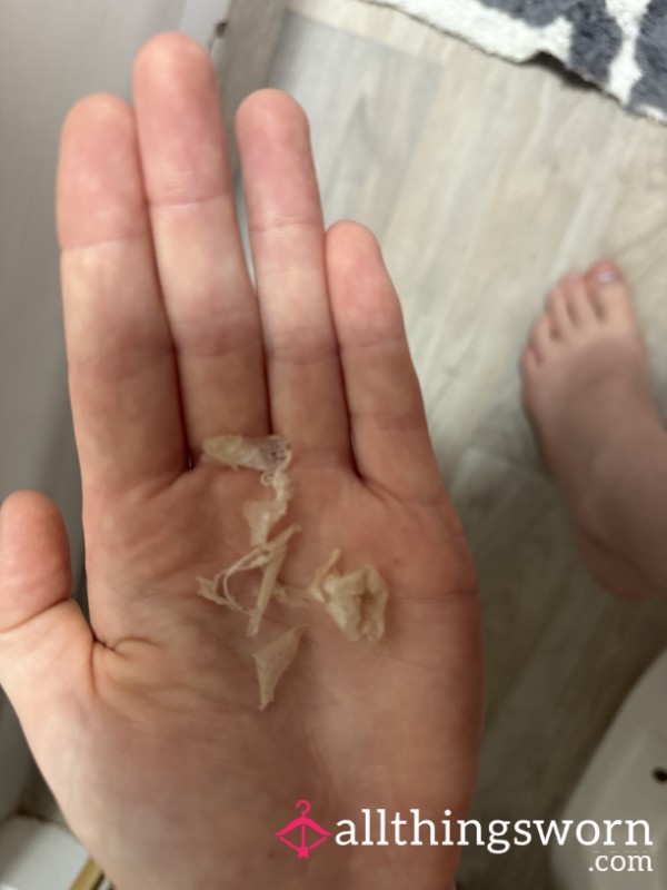 Dead Skin Off My Feet