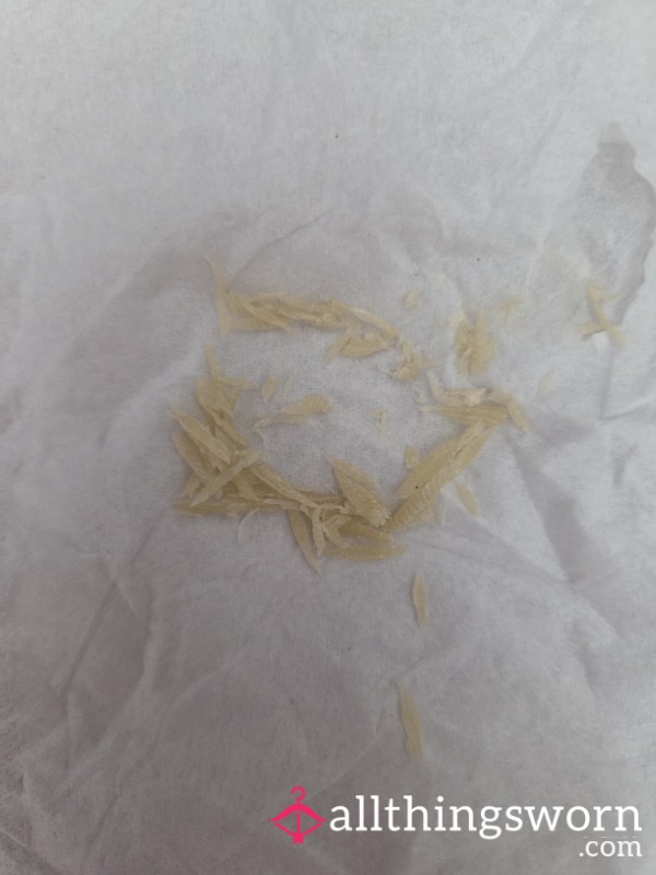 Dead Skin Removed From Feet.