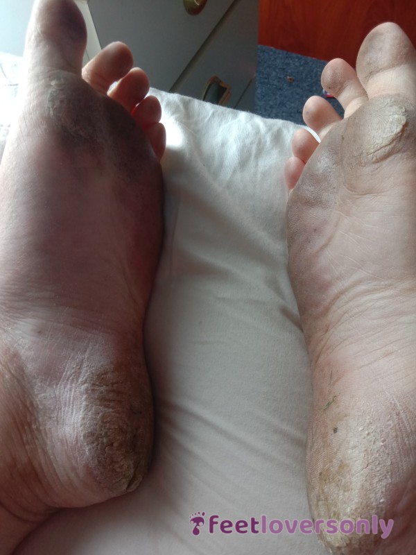 Dirty Feet