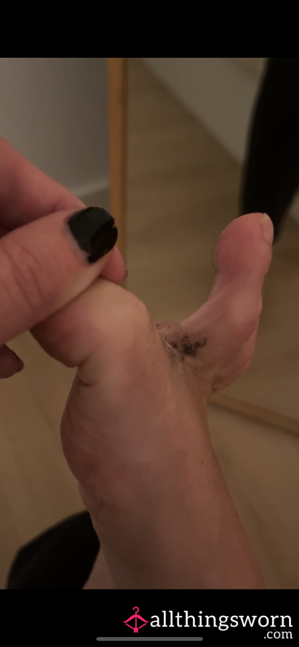 Dirty Feet