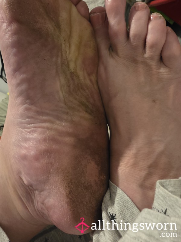 Dirty.feet.wipes
