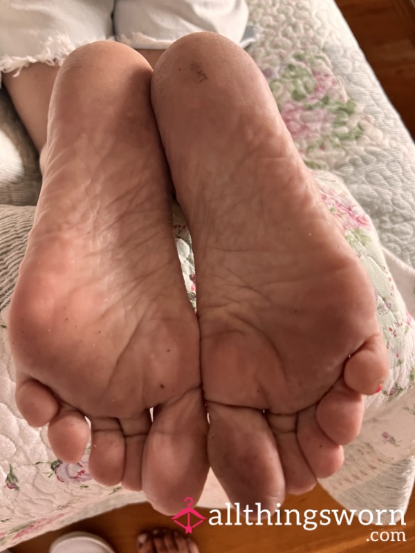 Dry Ashy Feet