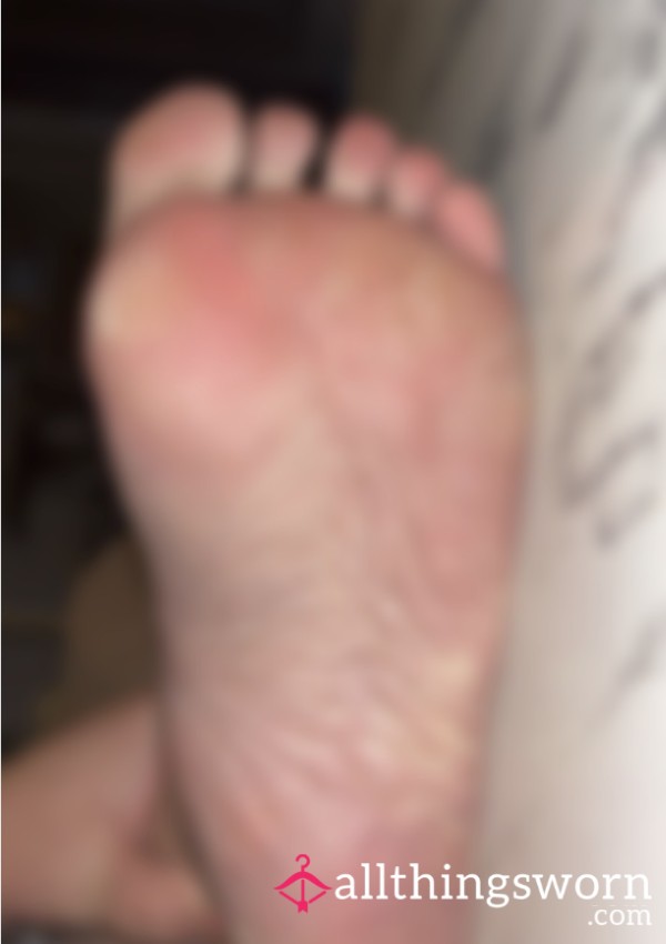 Dry Cracked Soles 😮‍💨👣💗