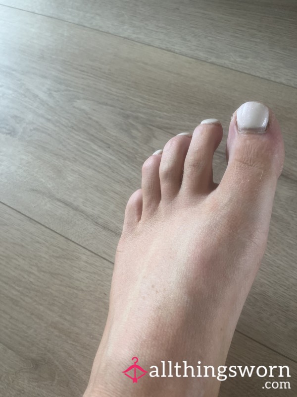 Dry Flaky Skin On My Feet