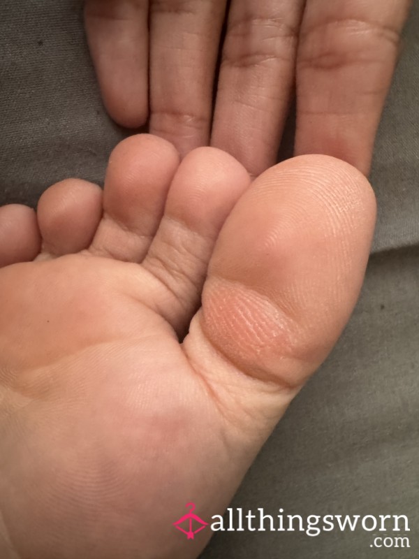 Dry Foot Skin Shavings