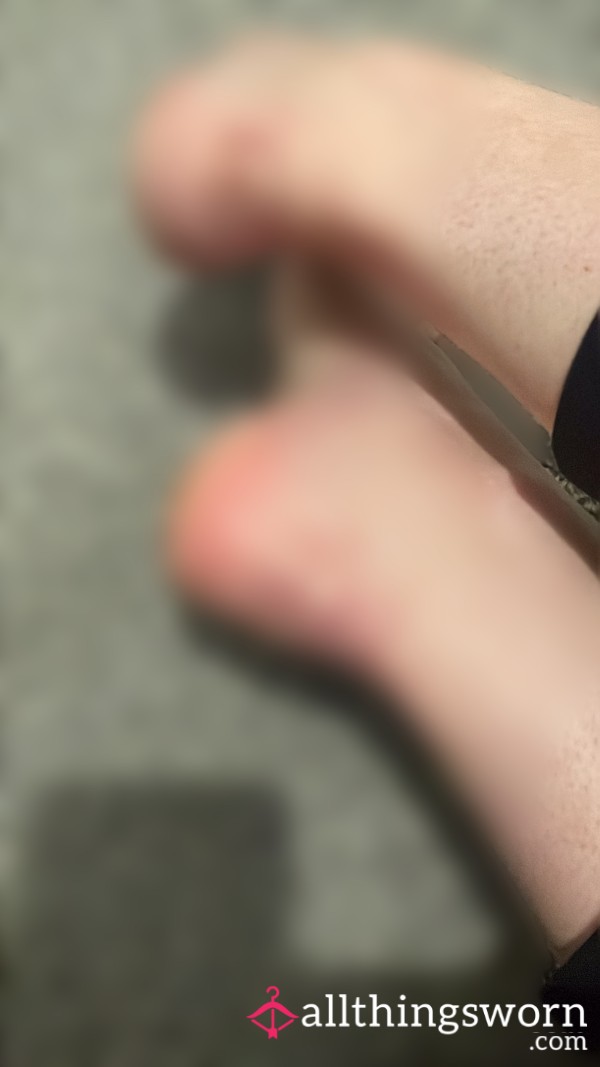 Dry, Hard And Blistered Feet After A Workout