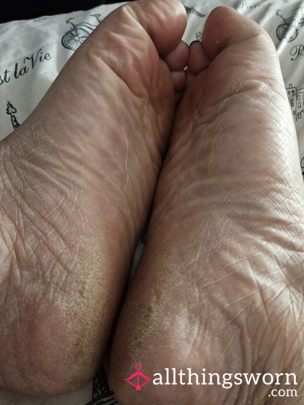 Dry S**y Soles