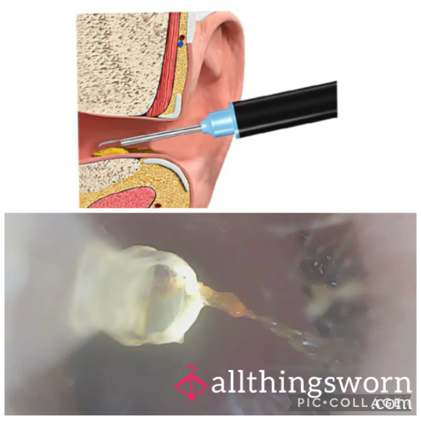 Ear P**king And Cleaning