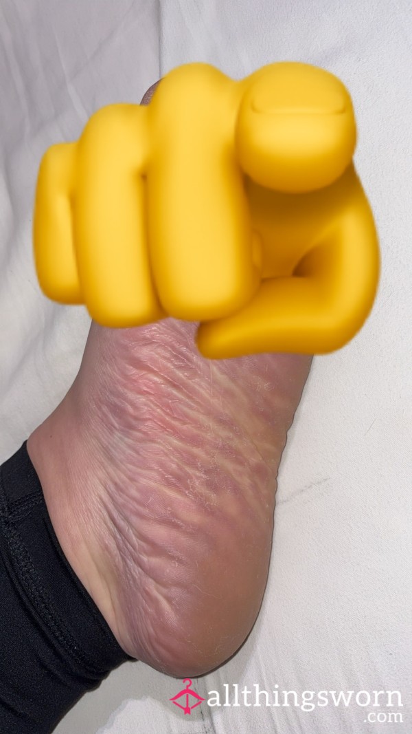Extremely Dry And Stinky Over Worked Feet 👣