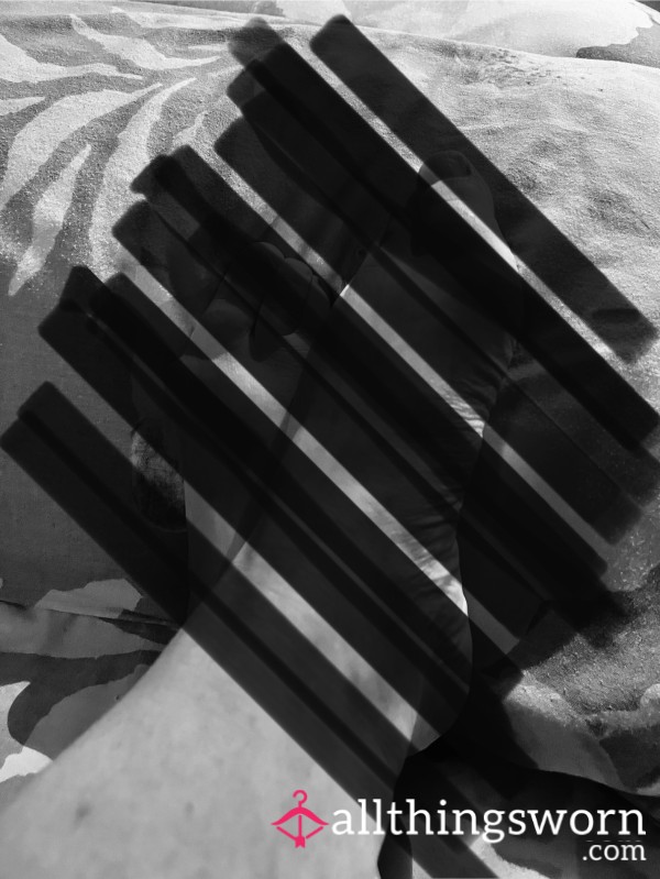 5 X Fabulous Photos Of My Fugly Feet