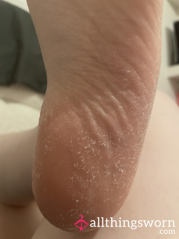 🧚‍♀️ Fairy Foot Dust 🦶